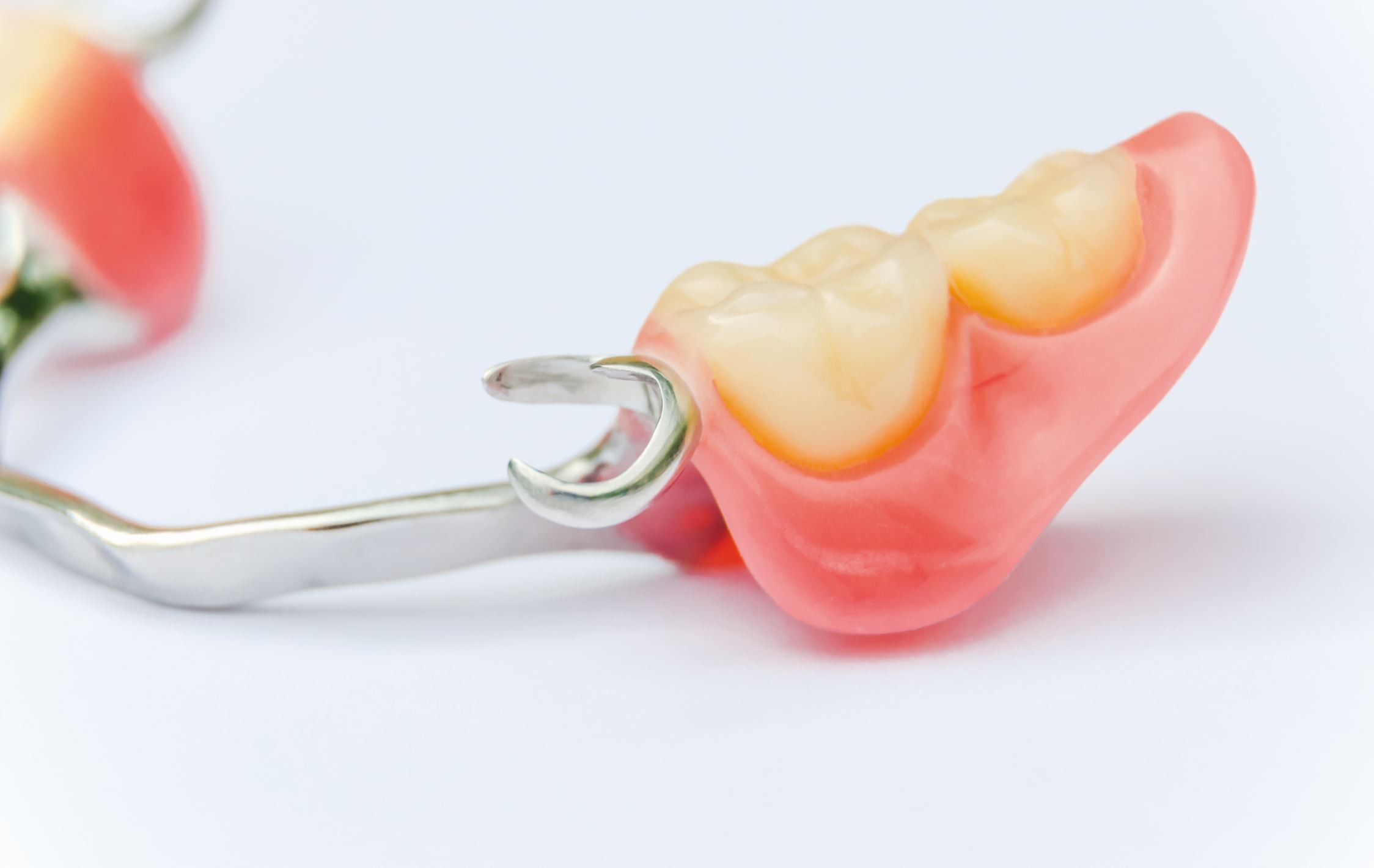 Răng giả tháo lắp: Tìm hiểu ưu nhược điểm và chi phí thực hiện